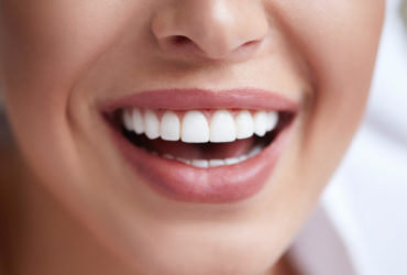Implantes dentales Avilés