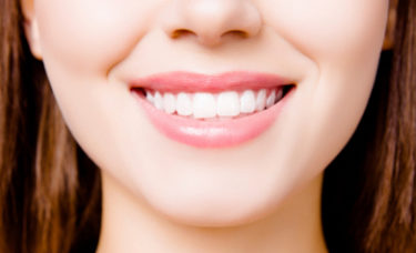 implantes-dentales-avilés-clínica-dental-lópez-rocha_2